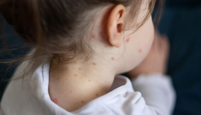 f9182d074a21fe392452deffeaa7fc2e